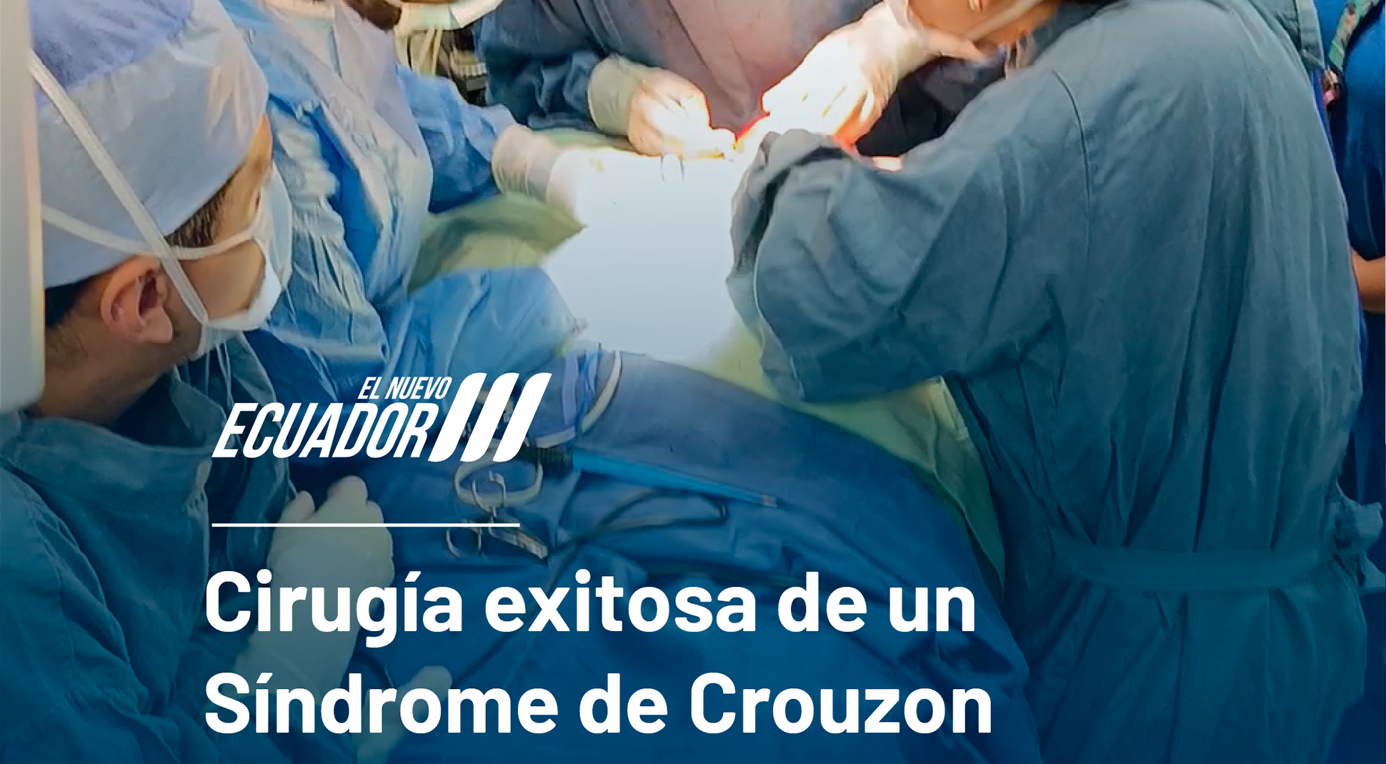 Síndrome de Crouzon